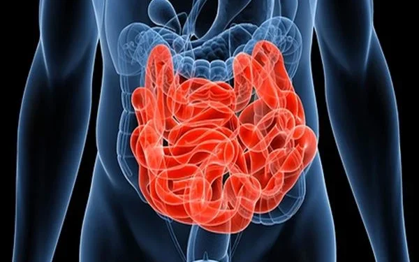 Cara Mengatasi Susah BAB